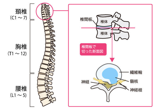 【首から肩・腕がしびれる…】それ、頚椎椎間板ヘルニアかもしれません