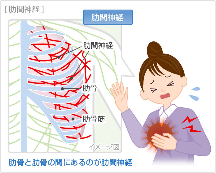 【背中から胸にかけてズキッとする痛み…】それ、“肋間神経痛”かもしれません