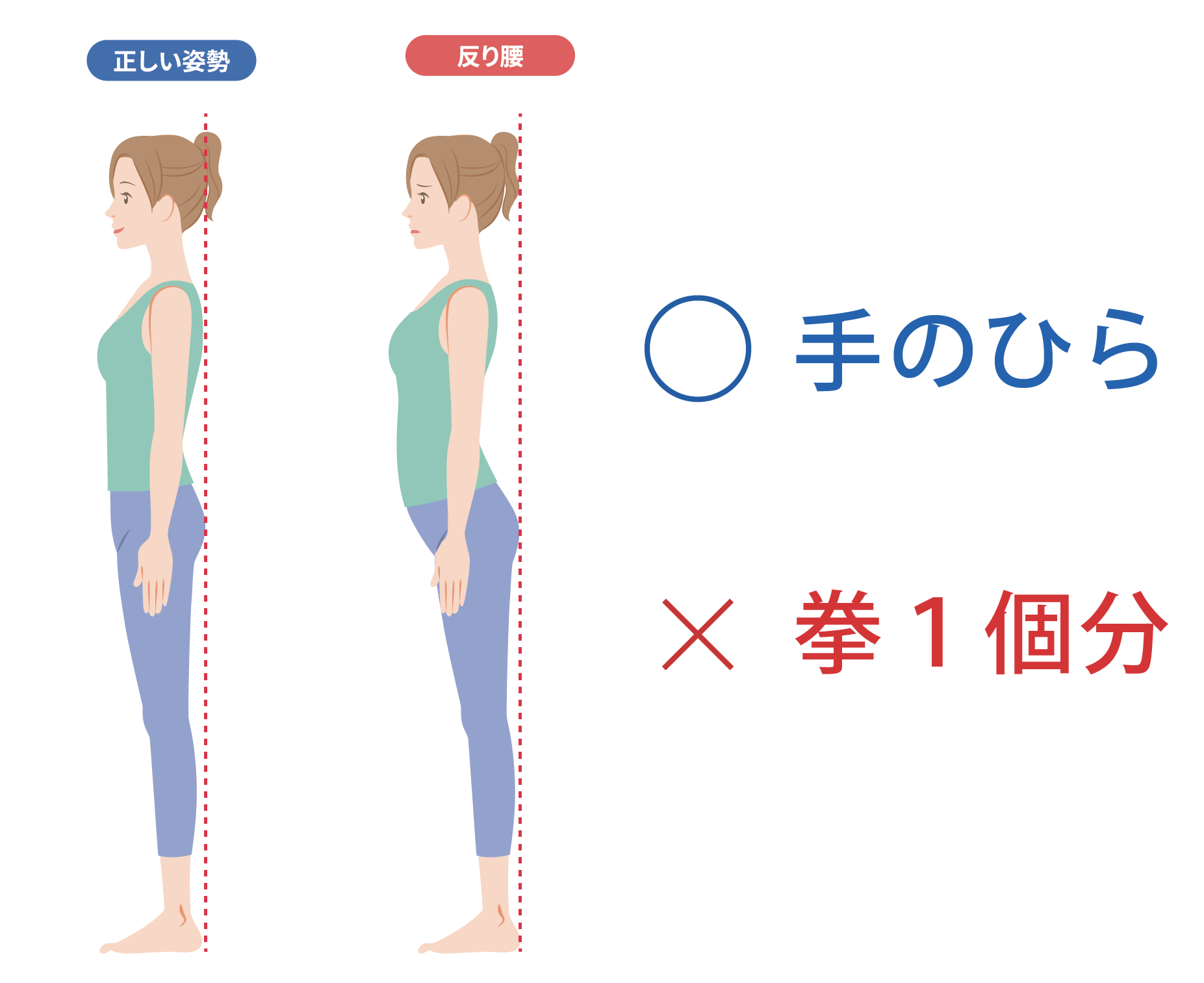 【その腰痛、実は“反り腰”が原因かもしれません】